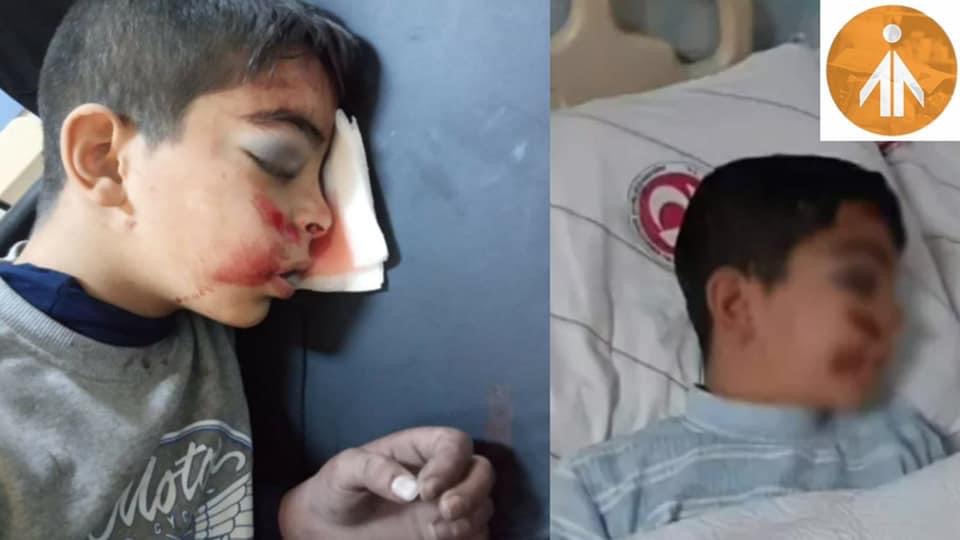 تركي يضرب طفل سوري بوحشية ليقارب الموت.